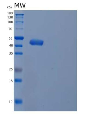 Recombinant Human Type I Inositol 1,4,5-Trisphosphate 5-Phosphatase/INPP5A Protein(C-6His)