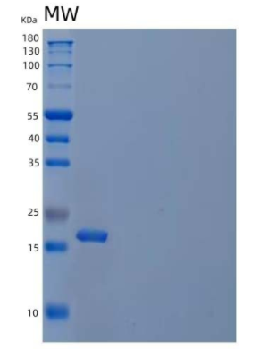 Recombinant Mouse Interleukin-1β/IL-1β Protein