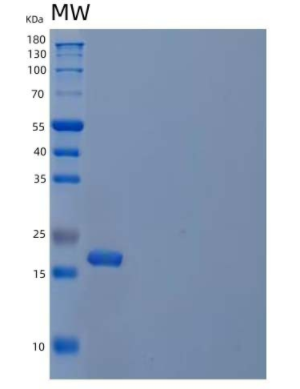 Recombinant Human Cystatin F/CST7 Protein(C-6His)