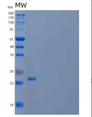 Recombinant Mouse Interleukin-3/IL-3 Protein(C-6His)