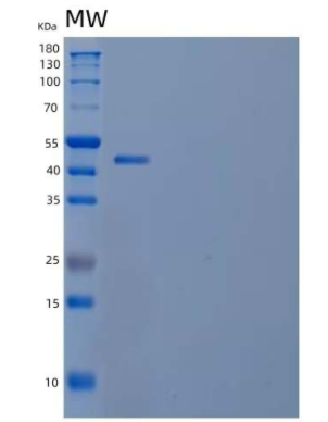 Recombinant Human Ubiquitin Thioesterase OTUB2/OTUB2 Protein(N-GST)