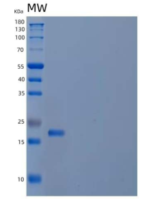 Recombinant Human Cytochrome b5/CYB5A Protein(N-6His)