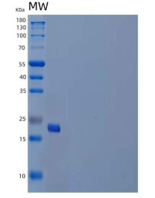 Recombinant Human Placental Lactogen/CSH1 Protein(C-6His)