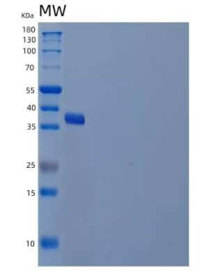 Recombinant Human Ubiquitin-Conjugating Enzyme E2 J2/UBE2J2 Protein(N-GST)