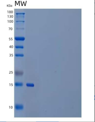 Recombinant Human PLA2G1B/PLA2/PLA2A Protein(C-6His)