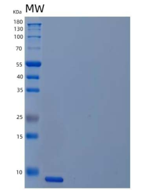 Recombinant Human Unique Cartilage Matrix-Associated Protein/UCMA Protein