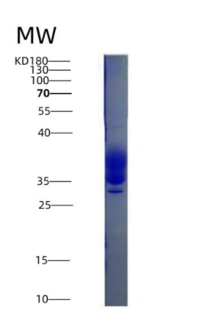 Eukaryotic Colony Stimulating Factor 1, Macrophage (MCSF)