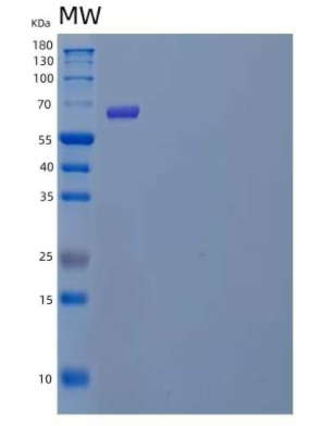 Recombinant Human POMGNT1 Protein(C-6His)