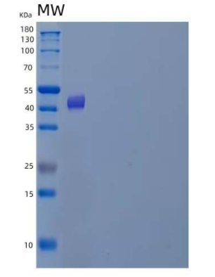 Recombinant Human Uroporphyrinogen Decarboxylase/UROD Protein(N-6His)