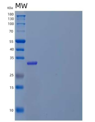 Recombinant Human Preadipocyte Factor-1/Protein δ Homolog 1/Pref-1/DLK-1 Protein(C-6His)
