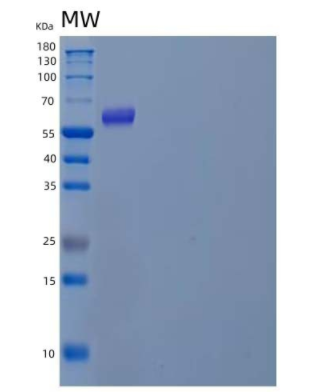 Recombinant Human Vasorin/SLITL2/VASN Protein(C-6His)