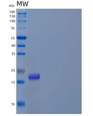 Recombinant Human Prefoldin Subunit 4/PFDN4 Protein(N-6His)