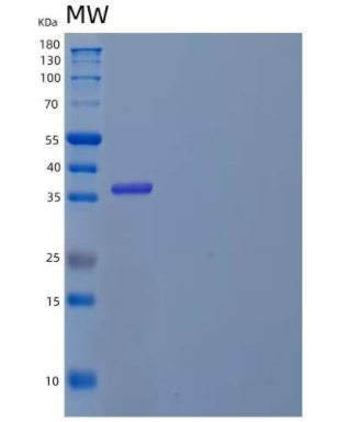 Recombinant Human Interleukin-5 Receptor Subunit Alpha/IL-5 Rα Protein(C-6His)