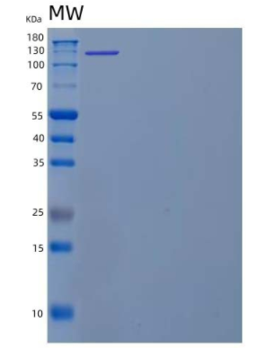 Recombinant Human Vinculin Protein