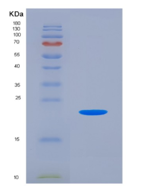 Eukaryotic Colony Stimulating Factor 2, Granulocyte Macrophage (GM-CSF).