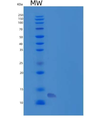 Recombinant Human Osteocrin Protein(N-6His)