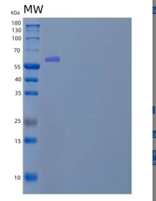 Recombinant Human Karyopherin Subunit α-2 /KPNA2/IPOA1 Protein(N-6His)