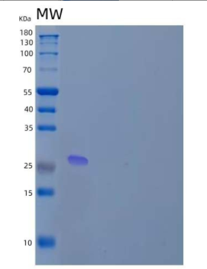 Recombinant Human Zinc Finger MYND Domain-Containing Protein 19/ZMYND19 Protein(N-6His)