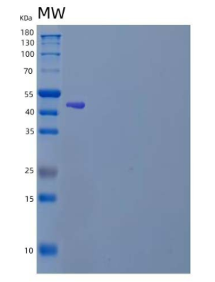 Recombinant Human Zinc Finger Protein 70/ZNF70 Protein(N-6His)