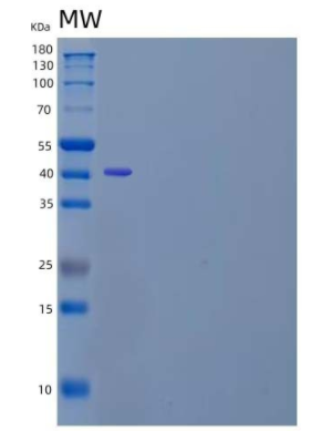 Recombinant Human α-Parvin/PARVA/MXRA2 Protein(C-6His)