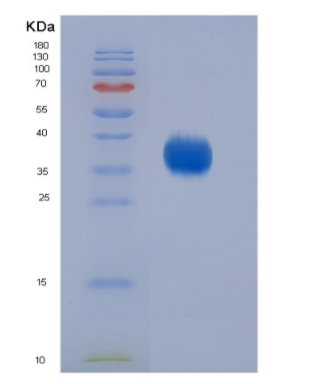 Eukaryotic Cluster Of Differentiation 2 (CD2)