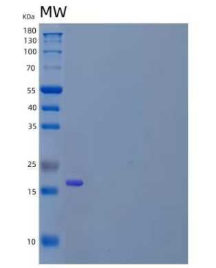 Recombinant Mouse Tissue Inhibitor of Metalloproteinases 2/TIMP-2 Protein(C-6His)