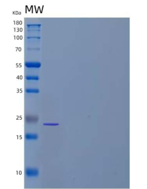 Recombinant Human Leucine-Rich Repeat-Containing Protein 3B/LRRC3B Protein(C-6His)
