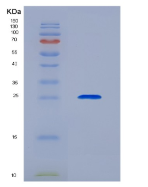 Recombinant Cluster Of Differentiation 72 (CD72)