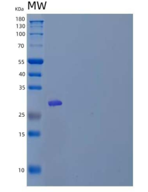 Recombinant Human ETS1/EWSR2/P54 Protein(N-6His)