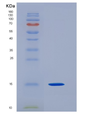 Recombinant Human Eukaryotic Translation Initiation Factor 1B/EIF1B Protein(N-6His)