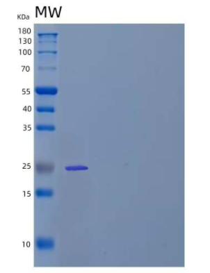 Recombinant Human Eukaryotic Translation Initiation Factor 4E/EIF4E Protein