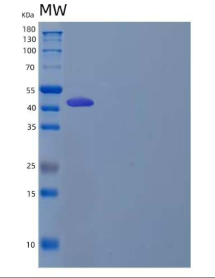 Recombinant Human LIM and Cysteine-Rich Domains Protein 1/LMCD1/Dyxin Protein(N, C-6His)