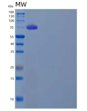 Recombinant Human Leukotriene A-4 Hydrolase/LTA4H Protein(C-6His)