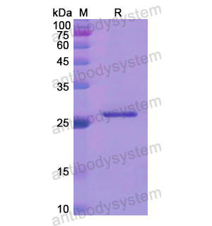 Recombinant Human COL4A1, N-His
