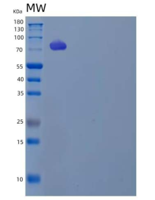 Recombinant Human Low-Density Lipoprotein Receptor/LDLR Protein(C-6His/AVI)
