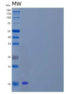 Recombinant Human Lymphocyte Antigen 6H/LY6H Protein(C-6His)