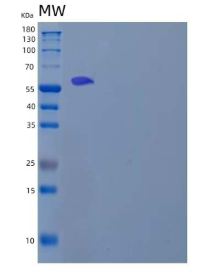 Recombinant Human Lymphocyte Cytosolic Protein 2/LCP2 Protein(C-6His, N-T7 tag)