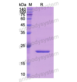 Recombinant Human APOC3, N-SUMO