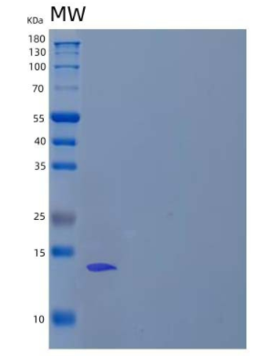 Recombinant Human Calcitonin/CALCA Protein(C-6His)