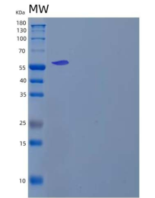 Recombinant Human Ribonuclease Pancreatic/RNASE1 Protein(C-6His)