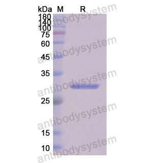 Recombinant Human FGG, N-His
