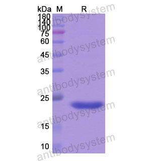 Recombinant Human MBP, N-His