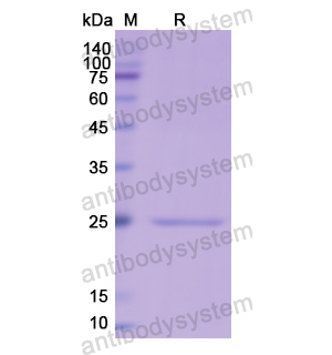Recombinant Human CRP, N-His