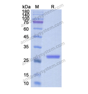 Recombinant Human APCS, C-His