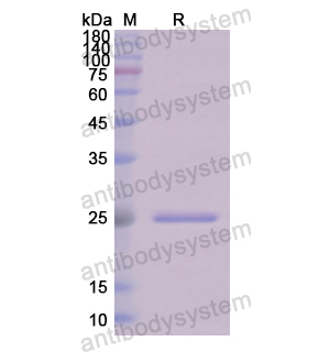 Recombinant Human C1QA, N-His