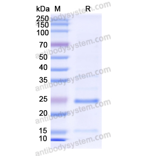 Recombinant Human ORM1/a1AGP, N-His