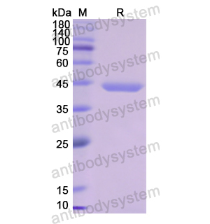 Recombinant Human DBP/GC, N-His