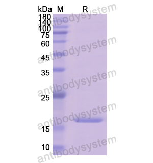 Recombinant Human HPX, N-His