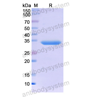 Recombinant Human MT2A, N-GST