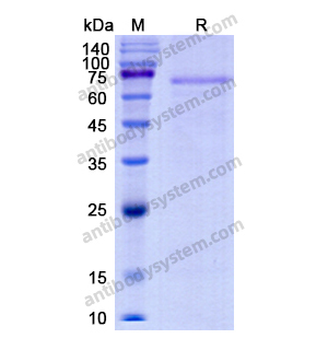 Recombinant Human F11, C-His